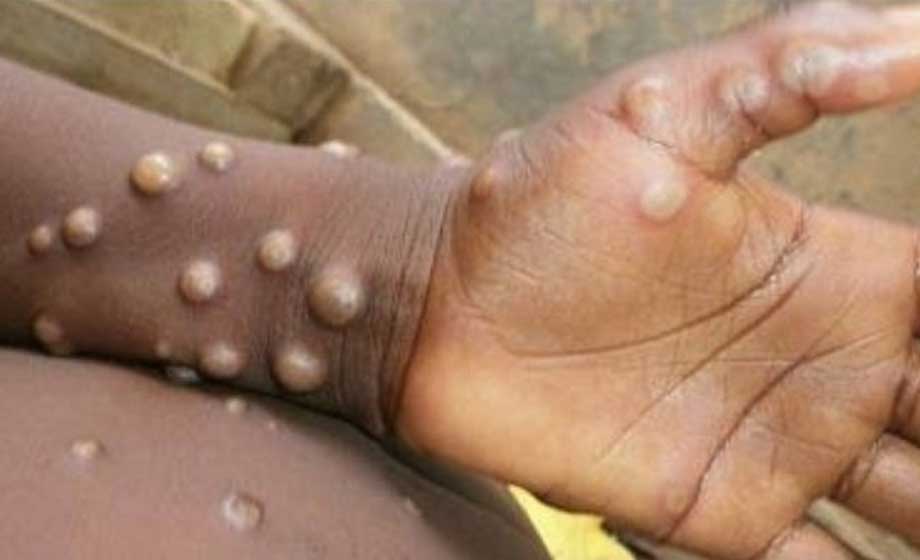 Kraftig ökning av apkoppor i Europa