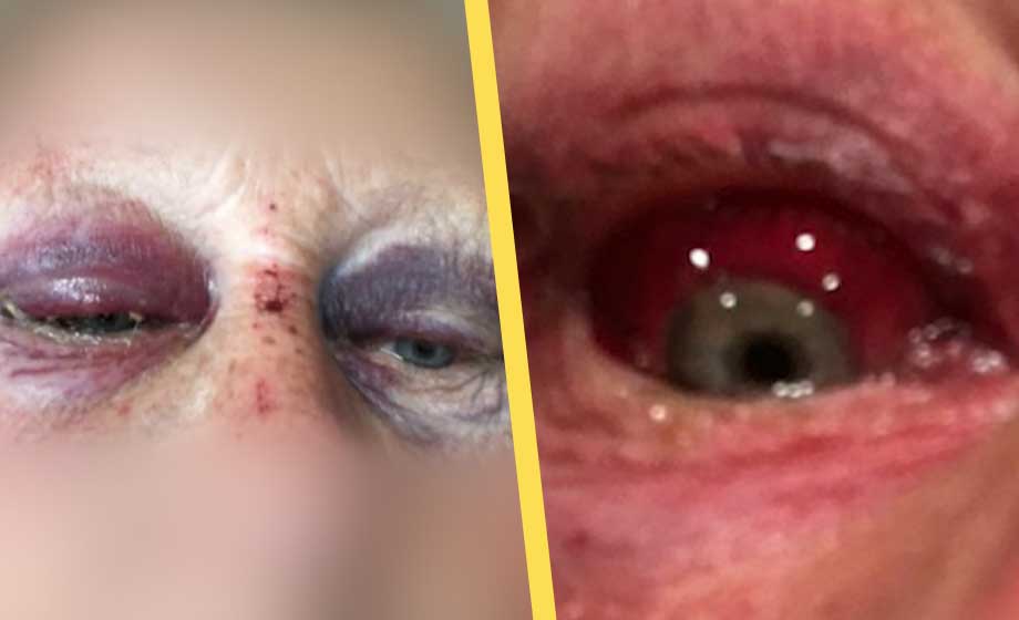 Kvinna brutalt misshandlad – rättegången inställd fyra gånger