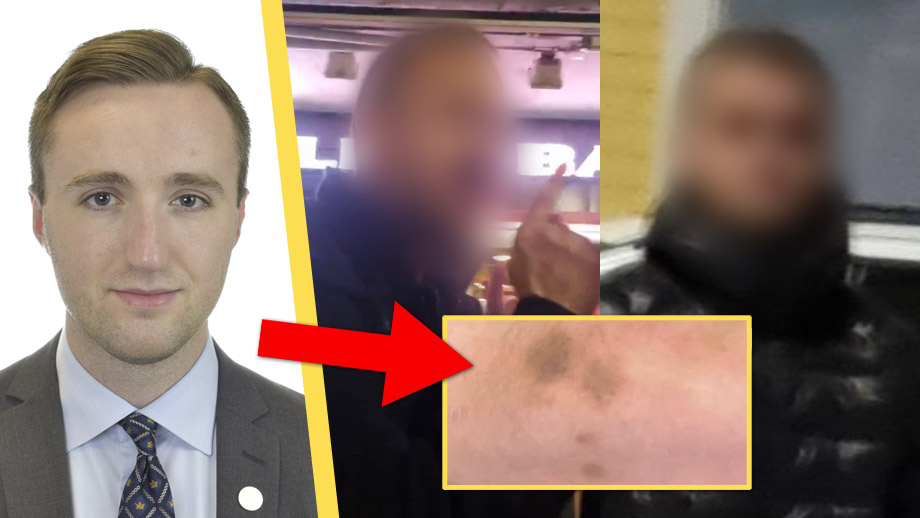 SD-politiker blåslagen på stan: ”De flög på mig flera stycken”