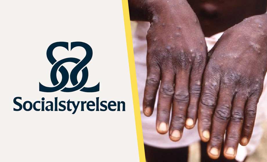 Apkoppor byter namn även i Sverige: ”Rasistiskt”