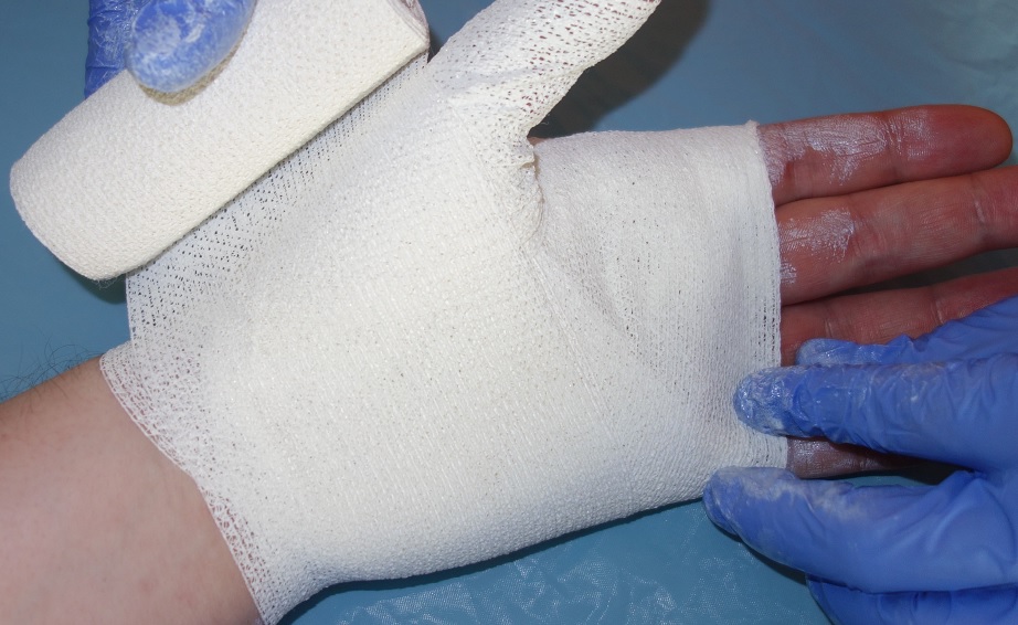 Tyg av räkskal räddar ukrainska liv