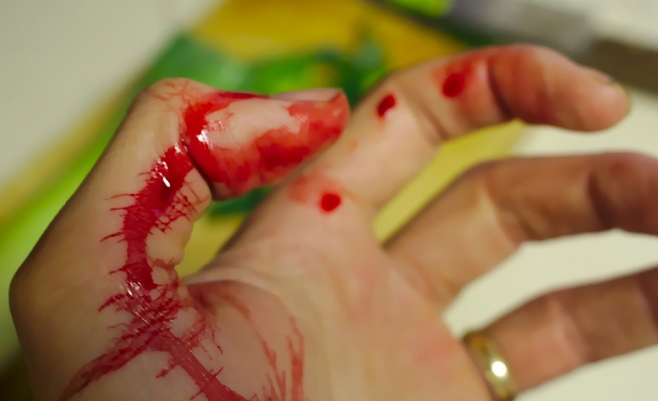 Kvinna träffades av kulregn i masskjutning vid köpcentrum