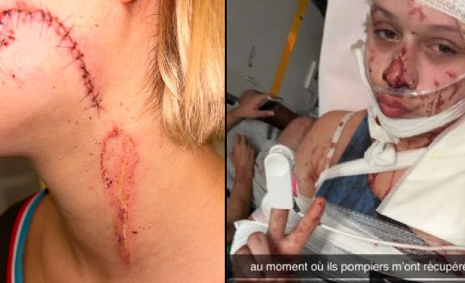 Tonårsflicka klädde sig ’fel’ – blev brutalt misshandlad av migranter