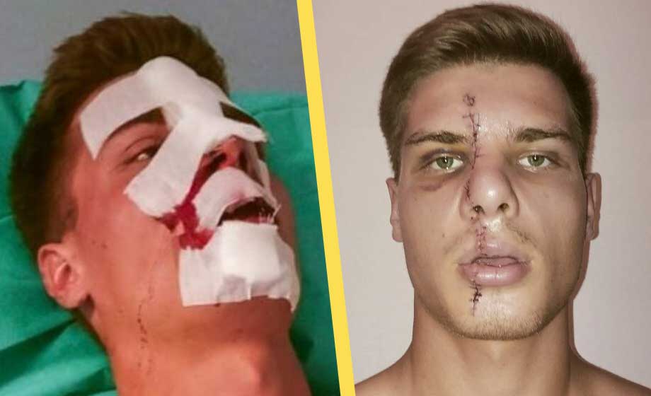 Flydde kriget i Ukraina men hamnade i ’helvetet i Italien’