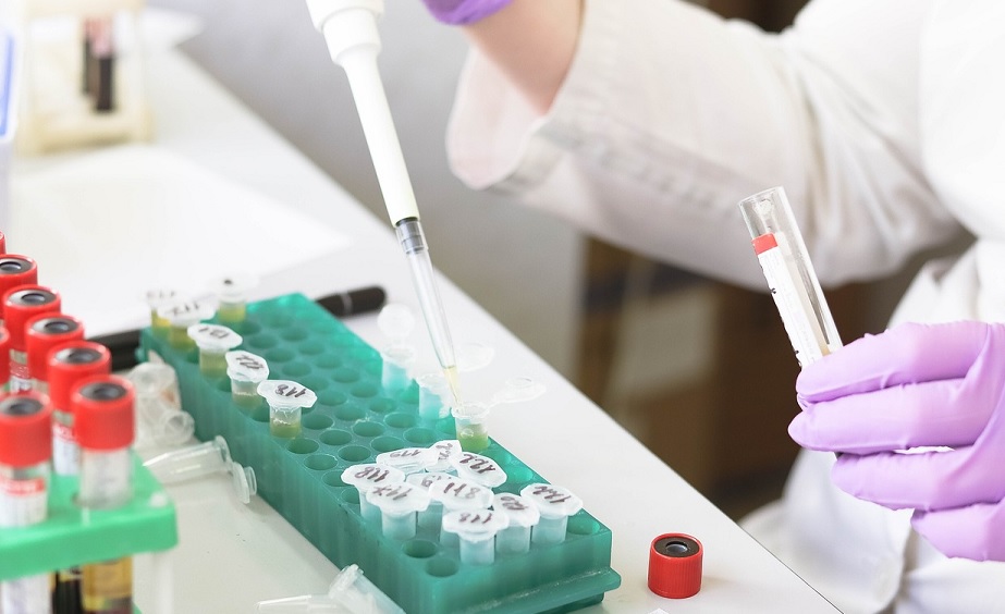 Nya rön: Antioxidanter hjälper cancer att växa