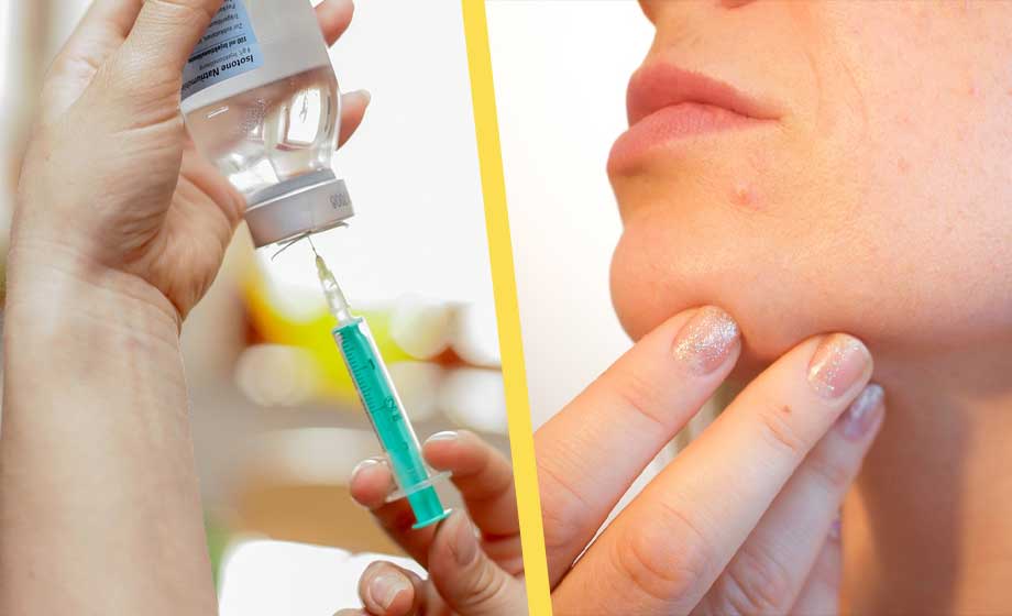 Huden reparerar sig själv med ny finsk uppfinning