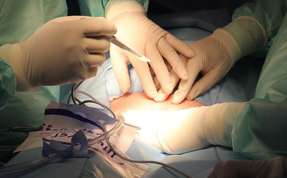 Gynekolog opererade bort livmodern i onödan på flera kvinnor