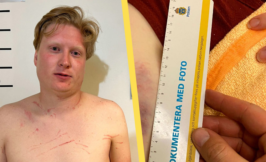 Anställd försökte våldta på LSS-boende – ”Jag var så jävla full”