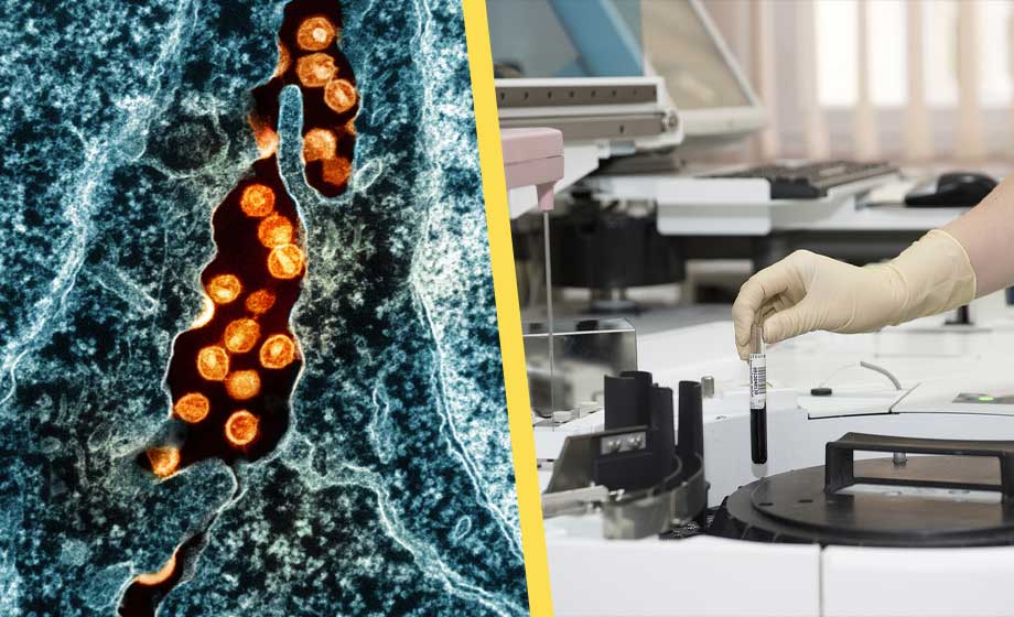 Informationsplikten för hiv-smittade kan avskaffas